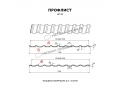 Профлист Металл Профиль МП-20x1100-R (ПЭ-01-3020-0,45)